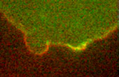 actin plasma membrane blebs blebbing Roh-Johnson
                  Goldstein
